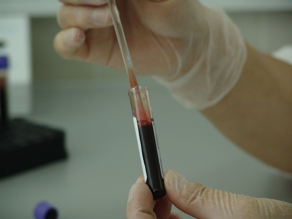Benefits of pharmaceutical engineering Benefits of pharmaceutical engineering